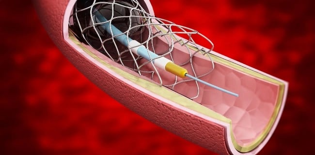 Sterile medical implant